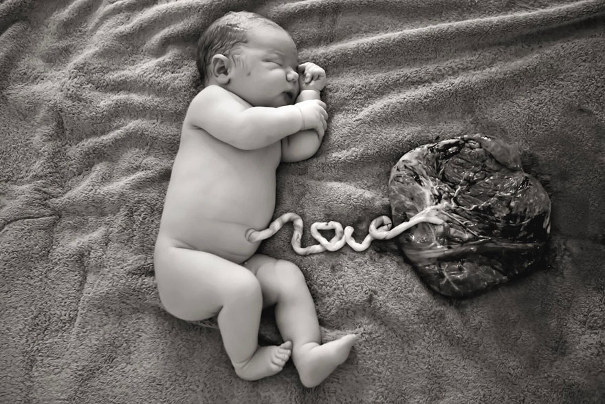 Austrálska fotografka zachytila bábätko spojené s placentou