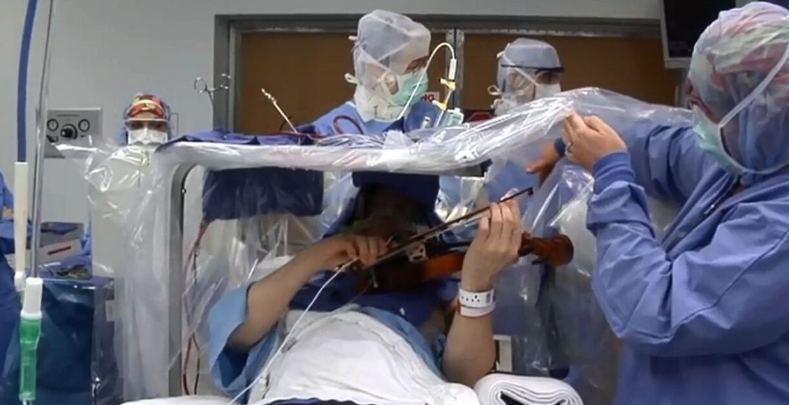 VIDEO Unikátne zábery: Pacientka hrala počas operácie mozgu na husliach