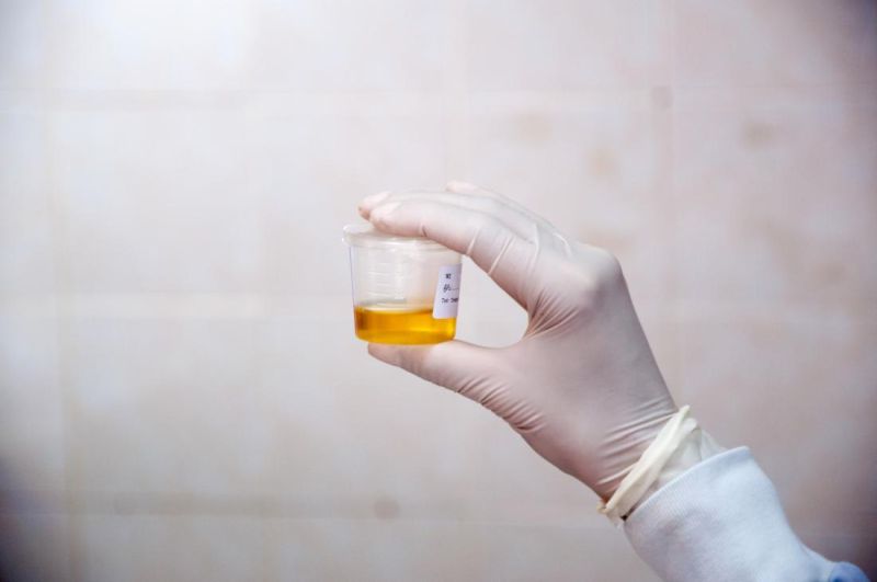 Triezva žena močila čistý alkohol: Lekári objavili nový syndróm